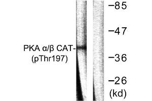 Western Blotting (WB) image for anti-PKA alpha/beta Cat (pThr197) antibody (ABIN1847296) (PKA alpha/beta Cat (pThr197) antibody)