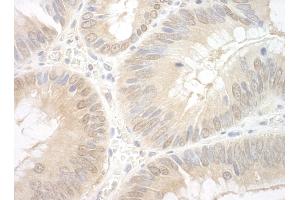 anti-ELL Associated Factor 2 (EAF2) (AA 150-200) antibody