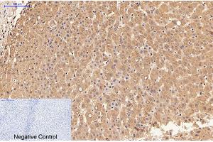 Immunohistochemical analysis of paraffin-embedded human liver tissue. (LALBA antibody)