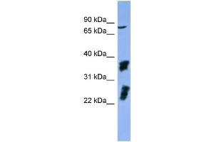WB Suggested Anti-FGFR2  Antibody Titration: 0. (FGFR2 antibody  (C-Term))