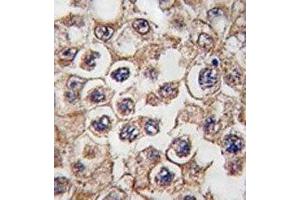 IHC analysis of FFPE human testis tissue stained with Insulin receptor-related antibody (INSRR antibody  (AA 16-47))