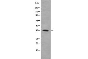 Western blot analysis GFI1B using 293 whole cell lysates