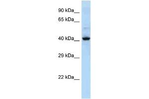 Host: Rabbit Target Name: KRT36 Sample Type: NCI-H226 Whole cell lysates Antibody Dilution: 1. (Keratin 36 antibody  (Middle Region))