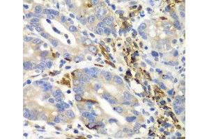AIMP1 antibody
