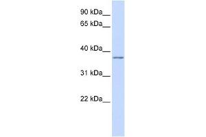 KCNAB2 antibody used at 1 ug/ml to detect target protein. (KCNAB2 antibody  (Middle Region))
