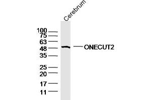 Mouse cerebrum lysates probed with ONECUT2 Polyclonal Antibody, Unconjugated  at 1:300 overnight at 4˚C. (ONECUT2 antibody  (AA 401-504))