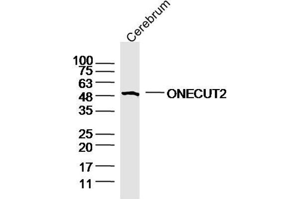 ONECUT2 anticorps  (AA 401-504)