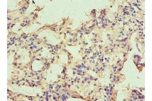 Immunohistochemistry of paraffin-embedded human lung tissue using ABIN7146531 at dilution of 1:100