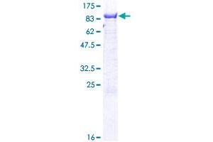 Phosphoglucomutase 2 Protein (PGM2) (AA 1-612) (GST tag)