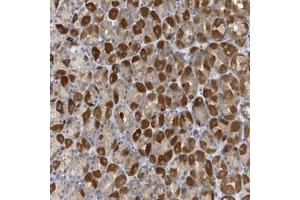 Immunohistochemical staining of human stomach with VTA1 polyclonal antibody  shows strong cytoplasmic positivity in Parietal cells at 1:50-1:200 dilution.