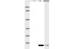 Lane 1: rat kidney lysates Lane 2: rat brain lysates probed with Anti CCL19/MIP-3 beta Polyclonal Antibody, Unconjugated (ABIN740505) at 1:200 in 4 °C. (CCL19 antibody  (AA 26-108))