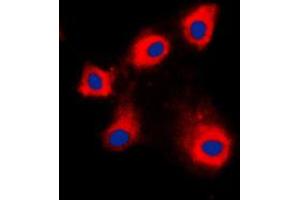 Immunofluorescent analysis of HSPE1 staining in NIH3T3 cells. (HSPE1 antibody  (Center))