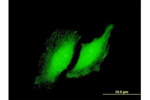 Immunofluorescence of purified MaxPab antibody to RYBP on HeLa cell. (RYBP antibody  (AA 1-228))
