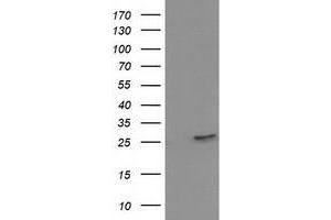 HEK293T cells were transfected with the pCMV6-ENTRY control (Left lane) or pCMV6-ENTRY HPGD (Right lane) cDNA for 48 hrs and lysed. (HPGD antibody)