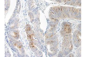 Image no. 2 for anti-Chemokine (C-C Motif) Ligand 20 (CCL20) antibody (ABIN465457) (CCL20 antibody)