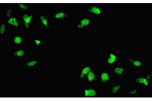 Immunofluorescent analysis of Hela cells using ABIN7155745 at dilution of 1:100 and Alexa Fluor 488-congugated AffiniPure Goat Anti-Rabbit IgG(H+L)