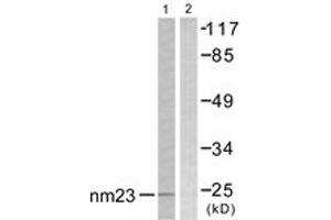 Western blot analysis of extracts from K562 cells, using NM23 Antibody. (NME1 antibody  (AA 91-140))