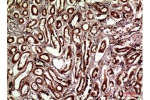Immunohistochemistry (IHC) analysis of paraffin-embedded Human Kidney, antibody was diluted at 1:100. (TLN1 antibody  (Internal Region))