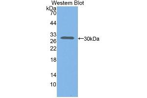 Detection of Recombinant CXCL16, Mouse using Polyclonal Antibody to Chemokine C-X-C-Motif Ligand 16 (CXCL16) (CXCL16 antibody  (AA 31-241))