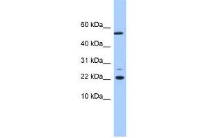 WB Suggested Anti-DPH4 Antibody Titration: 0.