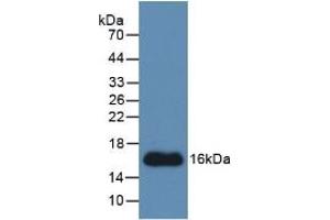 Detection of Recombinant CTGF, Human using Monoclonal Antibody to Connective Tissue Growth Factor (CTGF) (CTGF antibody  (AA 248-349))