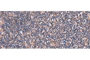 Immunohistochemistry of paraffin-embedded Human tonsil tissue using TTC38 Polyclonal Antibody at dilution of 1:85(x200) (TTC38 antibody)