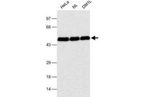 Western Blot Analysis detection of CUGBP1 in several cell lysates using CUGBP1 monoclonal antibody, clone 3B1 .