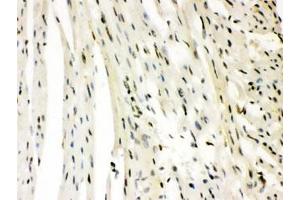 IHC testing of FFPE rat heart with SLUG antibody. (SLUG antibody)