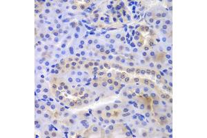 Immunohistochemistry of paraffin-embedded mouse kidney using PSMA6 antibody (ABIN6292835) at dilution of 1:100 (40x lens). (PSMA6 antibody)