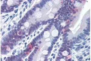 Human Small Intestine (formalin-fixed, paraffin-embedded) stained with CASP6 antibody ABIN337396 at 5 ug/ml followed by biotinylated goat anti-rabbit IgG secondary antibody ABIN481713, alkaline phosphatase-streptavidin and chromogen. (Caspase 6 antibody  (Cleavage Site))