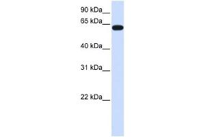 HS6ST3 antibody used at 1 ug/ml to detect target protein. (HS6ST3 antibody  (C-Term))