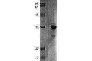 Validation with Western Blot (PYM Protein (Transcript Variant 2) (His tag))
