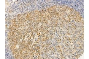 ABIN6255330 and ABIN6277725 at 1/100 staining human normal tonsil tissue by IHC-P. (ATR antibody  (pSer428))