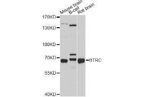 Western blot analysis of extracts of various cell lines, using BTRC antibody. (beta-TrCP antibody)