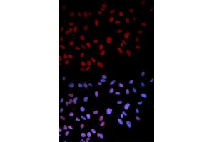 Immunofluorescence analysis of U2OS cells using Phospho-MAPK14-T180 antibody (ABIN5969910). (MAPK14 antibody  (pThr180))