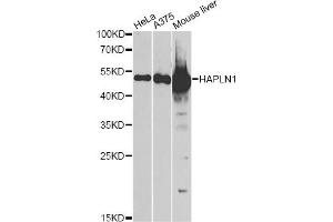 Western blot analysis of extracts of various cell lines, using HAPLN1 antibody (ABIN5973979) at 1/1000 dilution. (HAPLN1 antibody)
