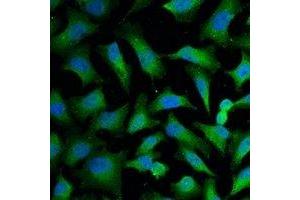 Immunofluorescence (IF) image for anti-Keratin 18 (KRT18) antibody (ABIN7305112)