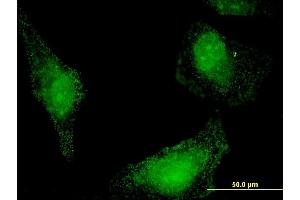 Immunofluorescence of monoclonal antibody to HSPA13 on HeLa cell. (HSPA13 antibody  (AA 375-470))