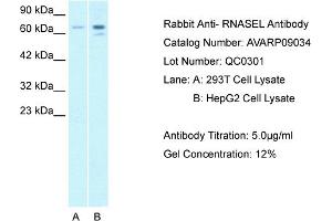 Host: Rabbit Target Name: RNASEL Sample Tissue: Human 293T Whole Cell Antibody Dilution: 1ug/ml (RNASEL antibody  (C-Term))