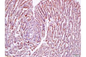 Formalin-fixed and paraffin embedded mouse stomach labeled with Anti-N acetylglucosamine kinase Polyclonal Antibody, Unconjugated (ABIN872749) at 1:200 followed by conjugation to the secondary antibody and DAB staining (NAGK antibody  (AA 201-300))