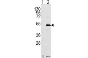 Western Blotting (WB) image for anti-Y Box Binding Protein 1 (YBX1) antibody (ABIN3002604) (YBX1 antibody)