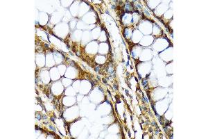 Immunohistochemistry of paraffin-embedded human colon using  Rabbit mAb (ABIN7265740) at dilution of 1:100 (40x lens). (ABCF1 antibody)