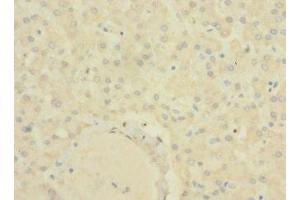 SLC22A9 antibody  (AA 45-143)