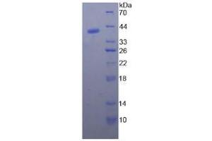 Image no. 1 for Natriuretic Peptides B (NPPB) (AA 26-131) protein (His tag,GST tag) (ABIN4988455)