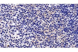 Immunohistochemistry (IHC) image for anti-Janus Kinase 2 (JAK2) (AA 508-800) antibody (ABIN7436057)