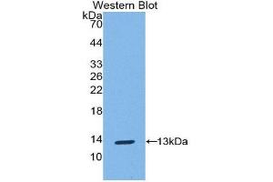 Western Blotting (WB) image for anti-S100 Calcium Binding Protein A10 (S100A10) (AA 1-95) antibody (ABIN1078495) (S100A10 antibody  (AA 1-95))