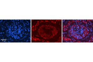 Rabbit Anti-EPRS Antibody   Formalin Fixed Paraffin Embedded Tissue: Human Testis Tissue Observed Staining: Cytoplasm in spermatogonia and Leydig cells Primary Antibody Concentration: N/A Other Working Concentrations: 1:600 Secondary Antibody: Donkey anti-Rabbit-Cy3 Secondary Antibody Concentration: 1:200 Magnification: 20X Exposure Time: 0. (EPRS antibody  (Middle Region))