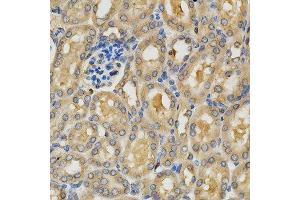 Immunohistochemistry of paraffin-embedded mouse kidney using PLK1 antibody at dilution of 1:200 (x400 lens)