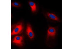 Immunofluorescent analysis of GRP78 staining in HeLa cells.