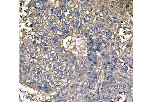 IHC analysis of ATP1B1 using anti-ATP1B1 antibody (ABIN7602014).